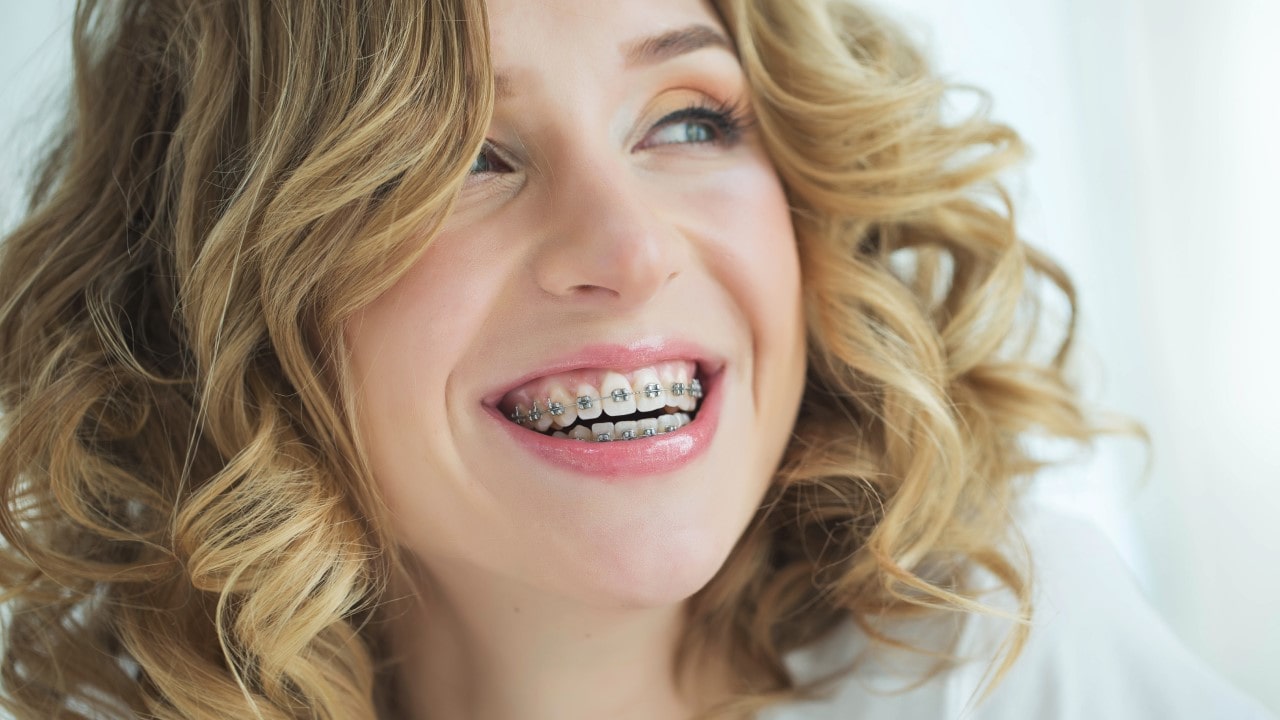 Adult Braces Orthodontists Fort Wayne IN