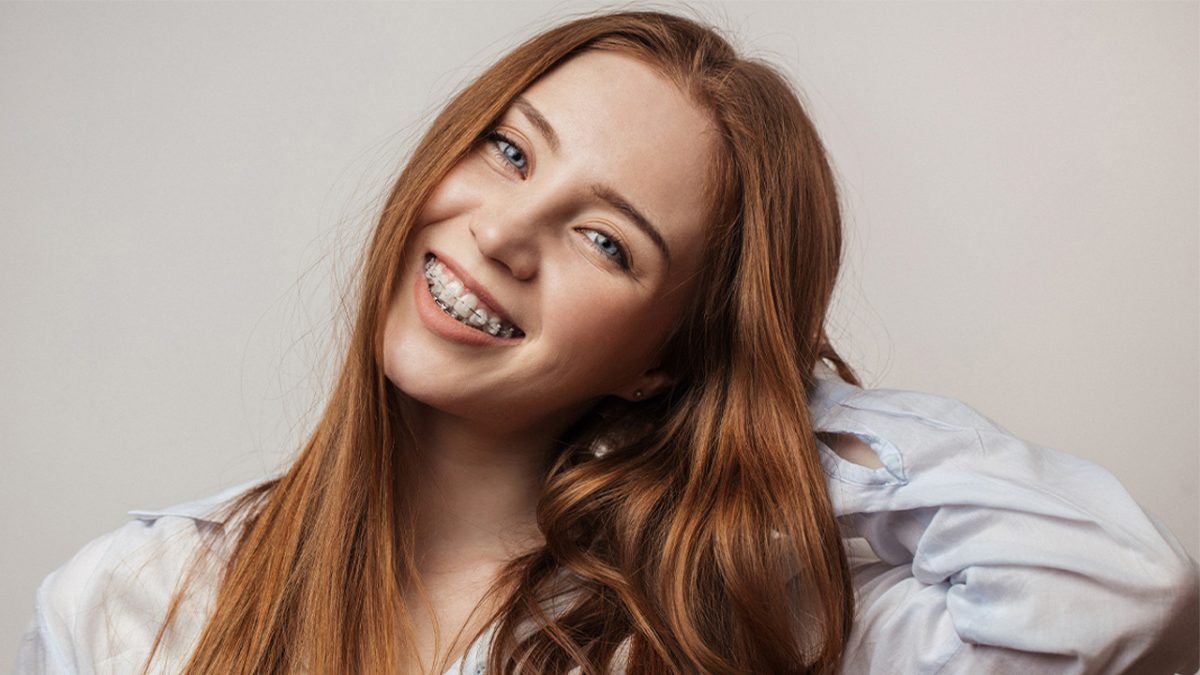 Fort Wayne In Ceramic Braces Orthodontists