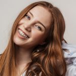 Fort Wayne In Ceramic Braces Orthodontists
