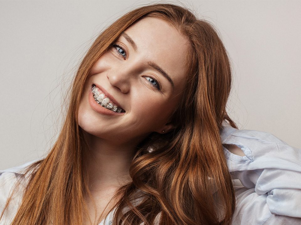 Fort Wayne In Ceramic Braces Orthodontists