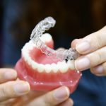 Fort Wayne In Invisalign Orthodontists